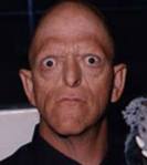 [Picture of Michael Berryman]
